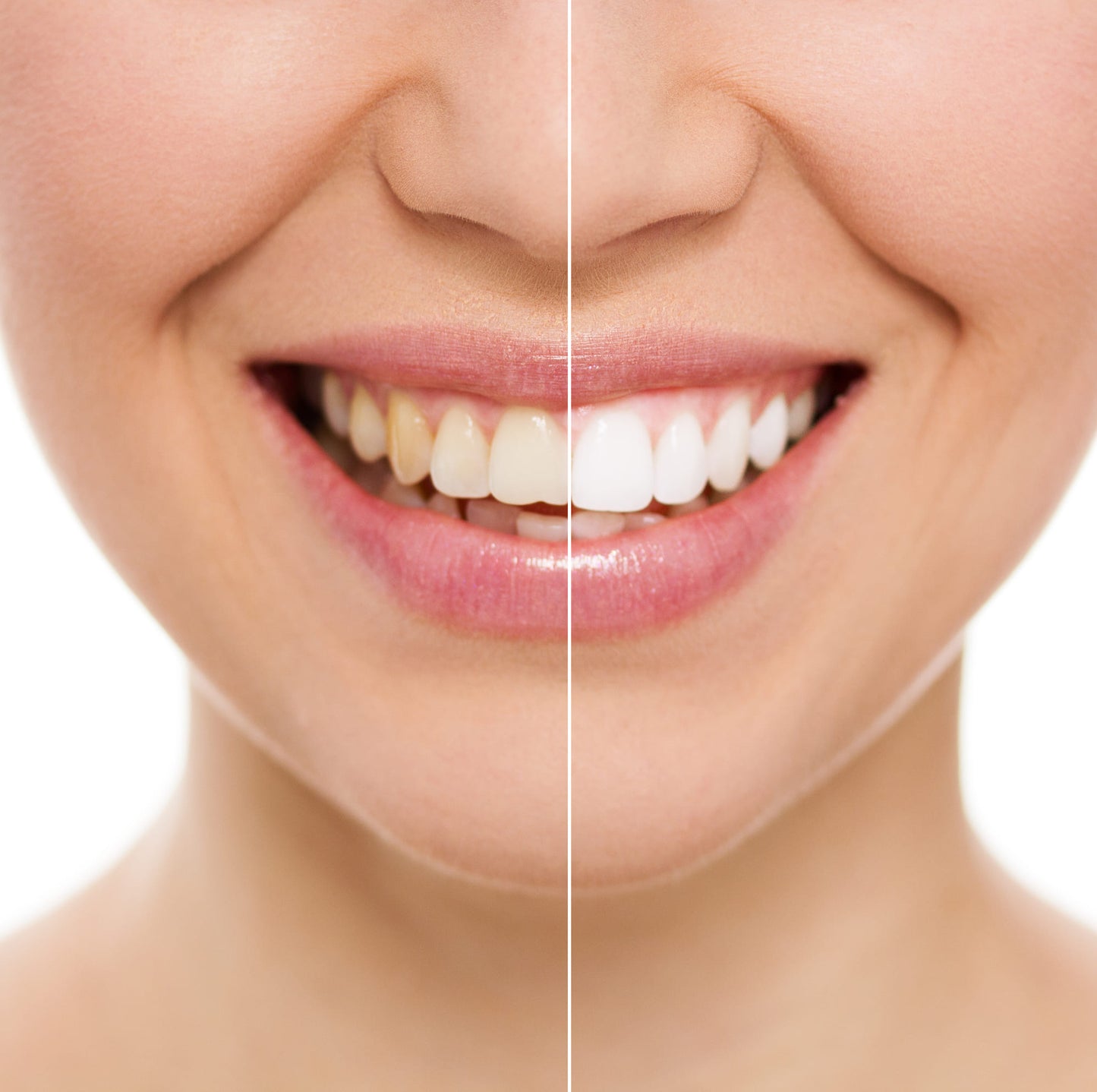 Crest 3D White Whitening Strips クレスト ホワイトニング テープ 【10セット/20枚】